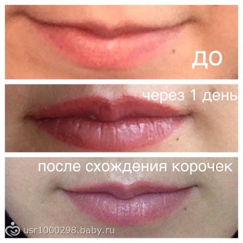 Как сходит корка с губ после татуажа Как сходит корка с губ после татуажа