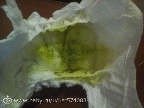Почему у ребенка в 3 месяца зеленый кал Почему у ребенка в 3 месяца зеленый кал