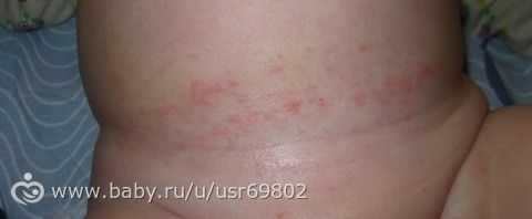 Потничка на шей Потничка на шей