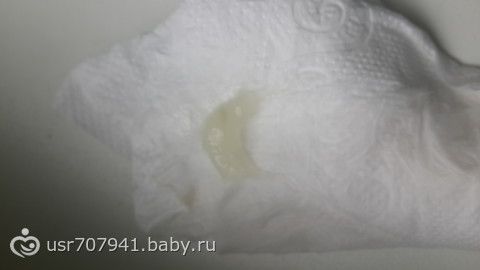 Пробка беременных как выглядит 4
