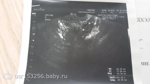 Как принимать дюфастон, чтобы забеременеть?
