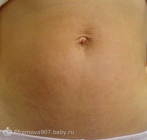 Месячные после эрозии Малыш кряхтит и тужится