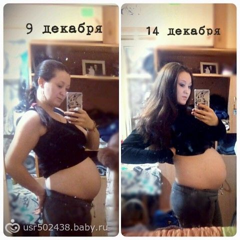Беременность чешутся растяжки Беременность чешутся растяжки