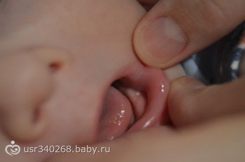 Фото как вылазит ребенок