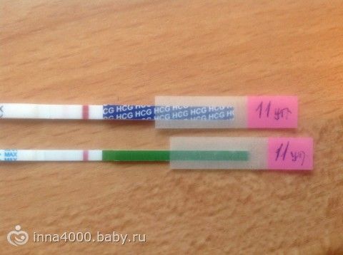 Внематочная беременность: симптомы, сроки, как определить с Артемовский роддом, Артем - Приморский край