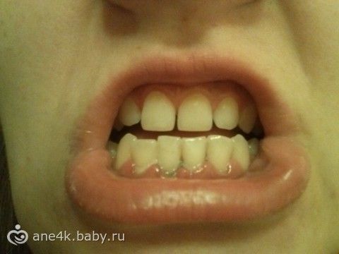Протезирование зубов в лиде отзывы Протезирование зубов в лиде отзывы