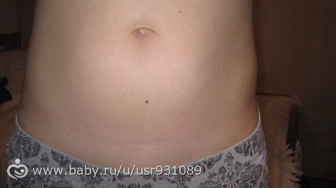Когда начинает появляться полоска на животе у беременных 61