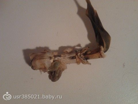 Народный метод лечения руками