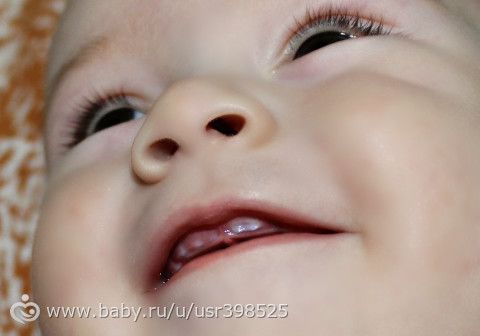 Как это лупитесь в дёснах Как это лупитесь в дёснах