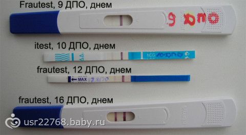 Контрацепция Википедия Зиновьева М. С., гинеколог, г. Нижний Новгород: отзывы о враче