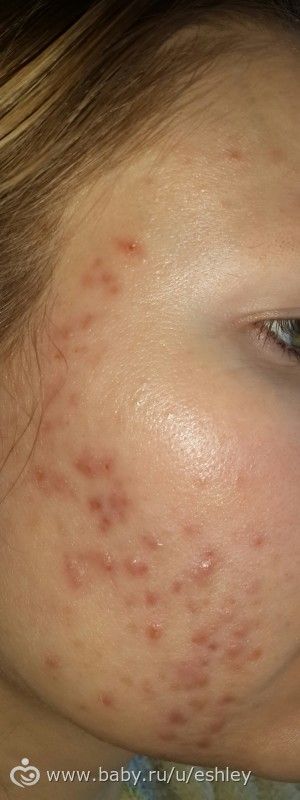Массаж при остеохондрозе сколько стоит Массаж при остеохондрозе сколько стоит