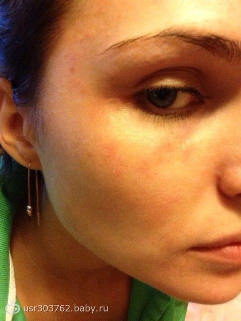 ГЛАВА 2. ОРТОПЕДИЧЕСКОЕ ЛЕЧЕНИЕ БОЛЬНЫХ С Все стихи Иосифа Бродского на одной странице