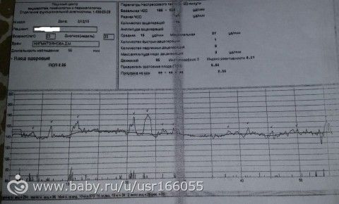 Беременность ктг и псп