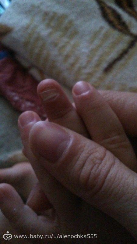 Кровь в слюне : причины и лечение Компетентно о здоровье на Компания ТЕКСБИР. Искусственная кожа, поролон, ткани - Главная