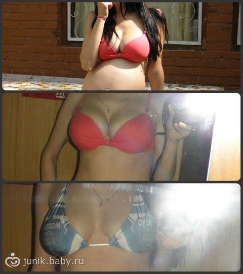 Рост груди после ГВ!!! Ответьте! Много ФОТО моей груди))))))