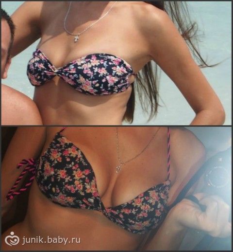 Рост груди после ГВ!!! Ответьте! Много ФОТО моей груди))))))