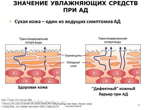 Экзема снять зуд народными средствами