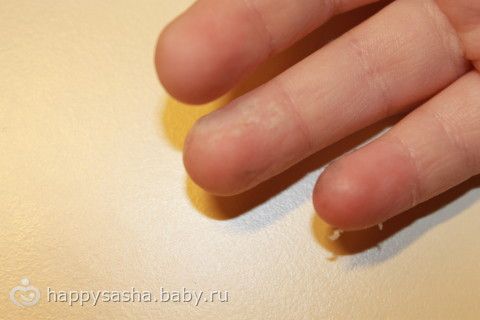 Лекарство о псориаза головы
