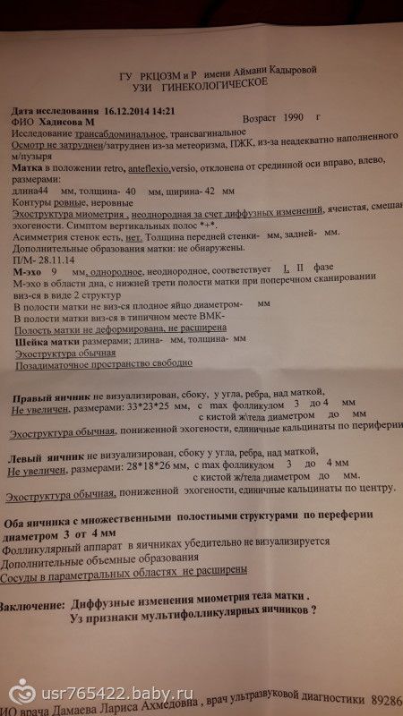 Грудь болит, живот ноет, а овуляции нет и не будет.(((