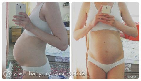 Люди не верят, что уже 34 недели :) (фото)