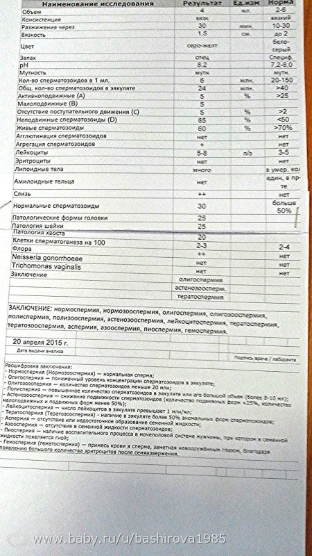 СГ что скажите?