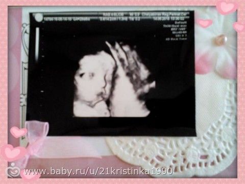 32-33 недели