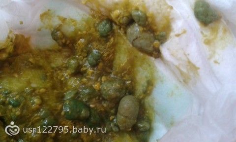 Понос зелёного цвета у ребёнка фото Понос зелёного цвета у ребёнка фото