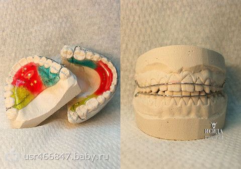 Пластинка на зубы фото для детей