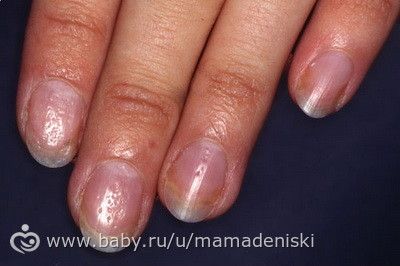 Будьте осторожны
