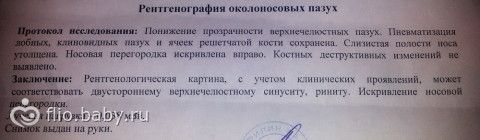 Девочки, кто ЛОР, помогите с синуситом!