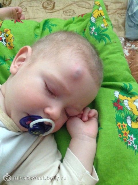 Боли в кишечнике слева внизу боли в пояснице