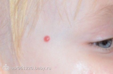 почему у человека запах изо рта почему у человека запах изо рта
