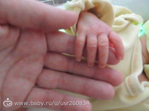 Нашему нетерпеливому счастью уже годик!!!!