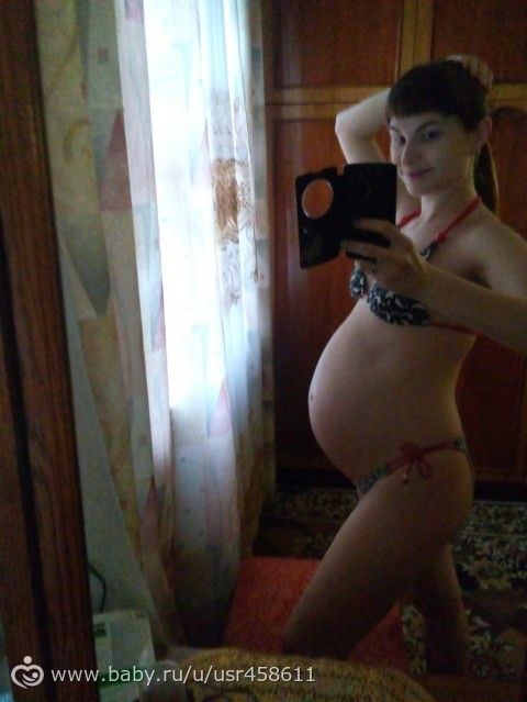 Вот какие &quot;арбузы&quot; на 31 неделе.