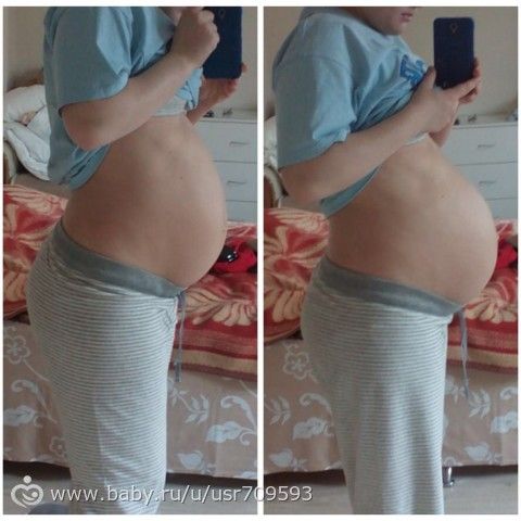 Беременность 29 недель тянет живот. Опустившийся живот у беременных. Опущение живота перед родами. Опущенный живот при беременности.