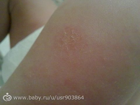 Девочки, из за чего это может быть???